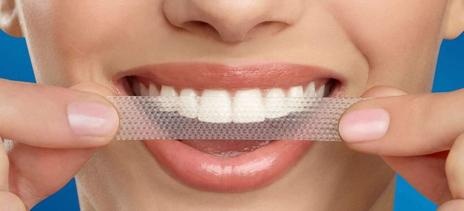 strisce sbiancanti denti 3