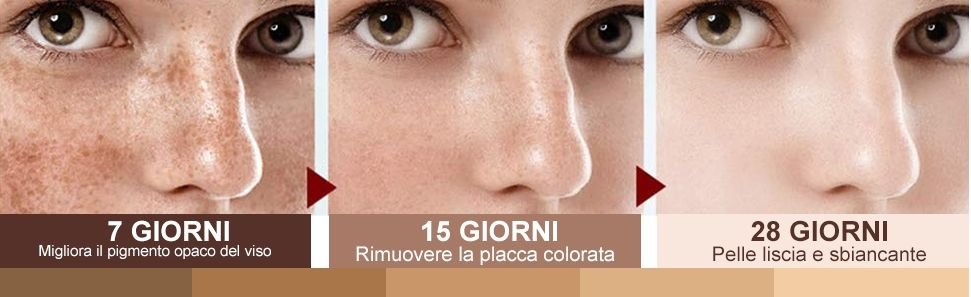 crema anti macchie risultato